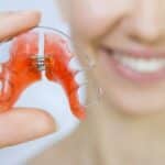 Patient holding an orange dental retainer with metal clasps and adjustment screw.