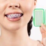 Girl with purple braces holding green orthodontic care case for travel essentials.