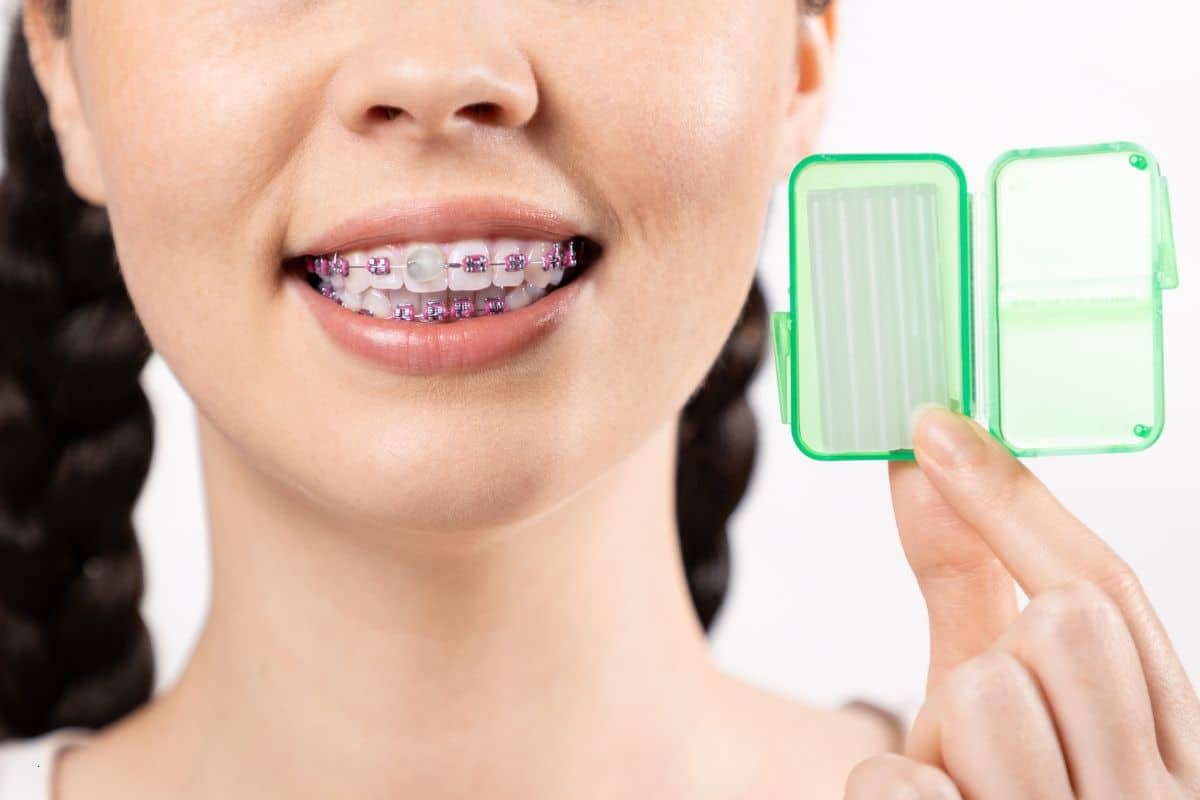Girl with purple braces holding green orthodontic care case for travel essentials.