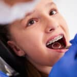 Young patient with metal braces smiling during dental examination with dentist.