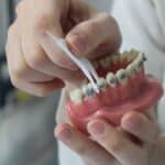 Dentist demonstrating floss pick technique on orthodontic model with braces.