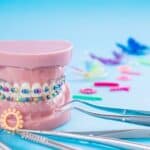 Dental model with colorful braces and orthodontic tools demonstrating interceptive treatment options.