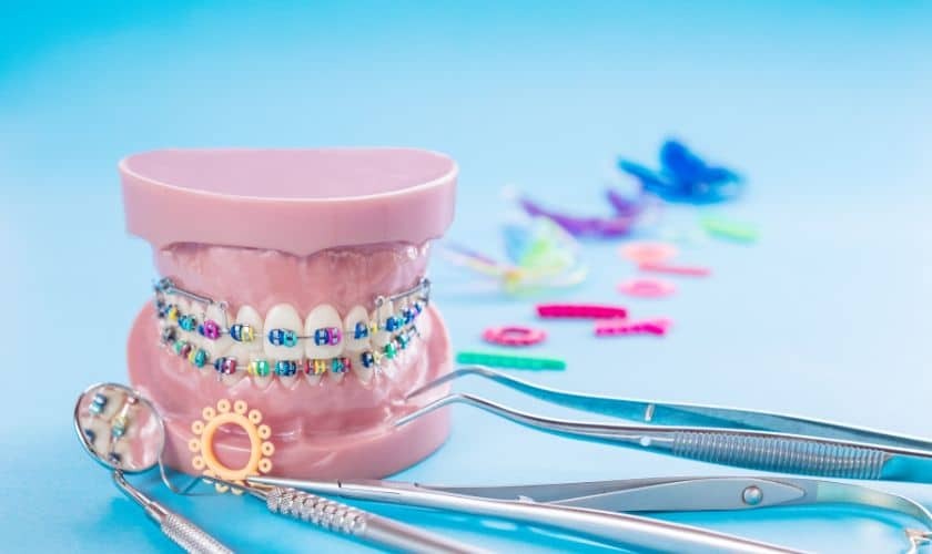 Dental model with colorful braces and orthodontic tools demonstrating interceptive treatment options.