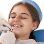 Young patient smiling while orthodontist places clear braces during dental treatment.