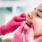 Young patient displaying metal braces during orthodontic examination and care.