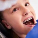 Young patient with metal braces receiving dental examination from orthodontist in blue gloves.