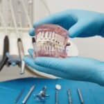 Orthodontist holding dental model with braces showing proper tooth alignment and treatment.