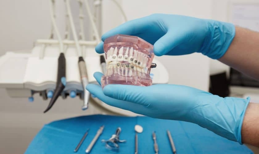 Orthodontist holding dental model with braces showing proper tooth alignment and treatment.