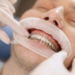 Dentist examining patient's teeth with metal braces during orthodontic treatment.