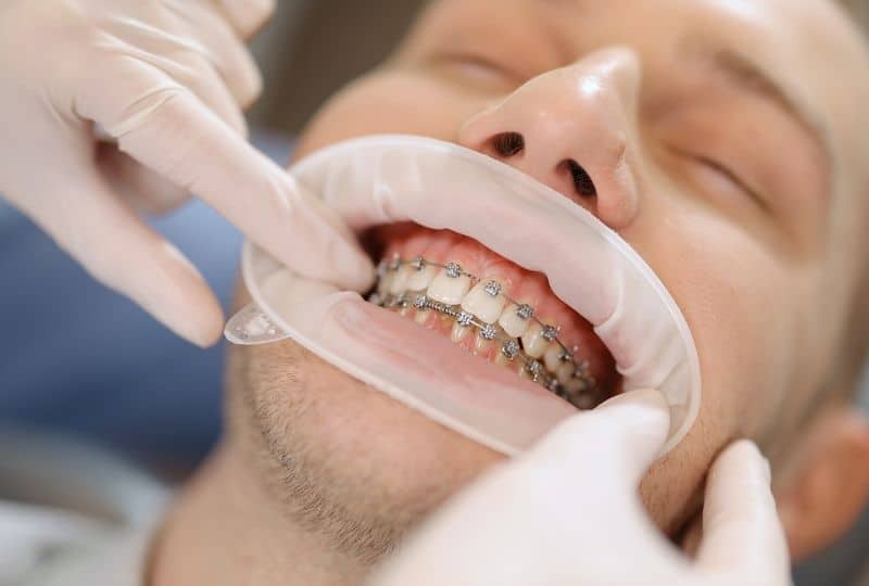 Dentist examining patient's teeth with metal braces during orthodontic treatment.