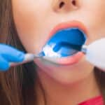 Pediatric patient receiving restorative dental treatment with blue protective barrier and white gauze.
