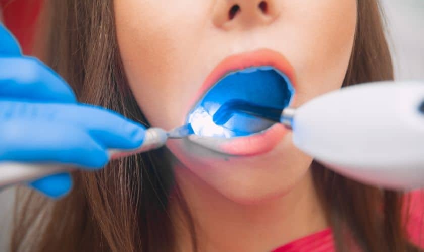 Pediatric patient receiving restorative dental treatment with blue protective barrier and white gauze.
