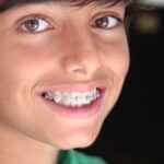 Smiling young patient with metal braces showing dental treatment progress.