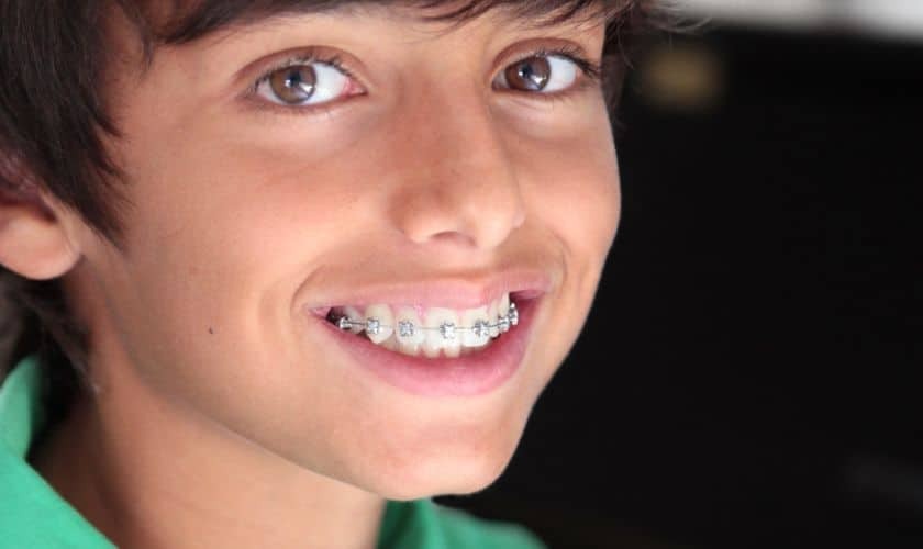 Smiling young patient with metal braces showing dental treatment progress.