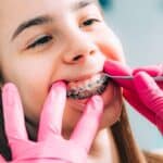 Young patient receiving orthodontic bracket adjustment during dental screening and treatment.