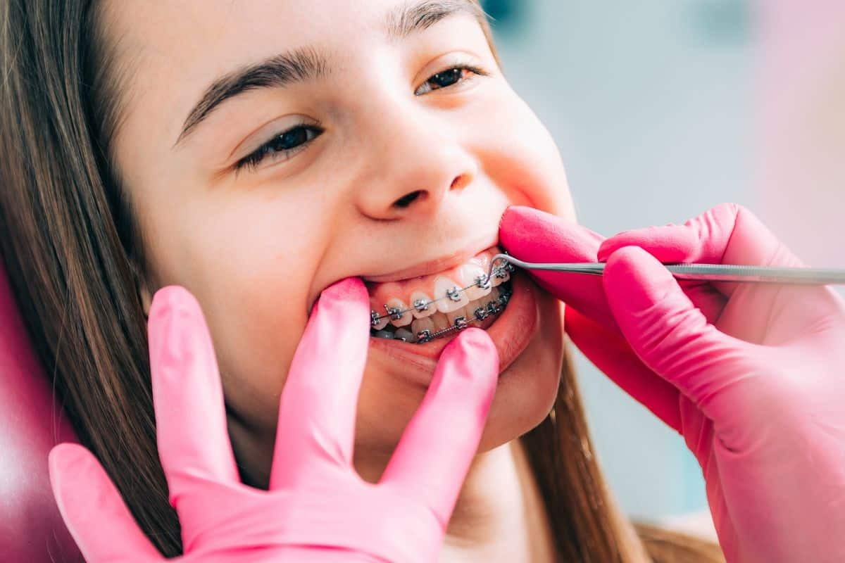 Young patient receiving orthodontic bracket adjustment during dental screening and treatment.