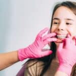 Orthodontist placing clear aligners on young patient's teeth during treatment consultation.