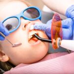 Young patient wearing blue protective glasses during dental filling procedure with dentist.