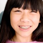 Young girl with dental braces smiling at camera, demonstrating proper orthodontic care and maintenance.