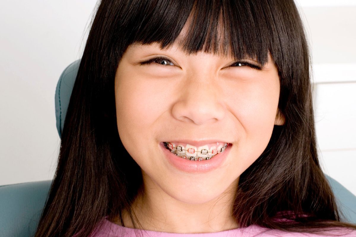 Young girl with dental braces smiling at camera, demonstrating proper orthodontic care and maintenance.
