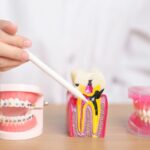 Dental education models showing tooth anatomy, braces, and tooth structure for orthodontic treatment planning.