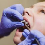 Orthodontist adjusting metal braces on young patient's teeth during dental treatment.