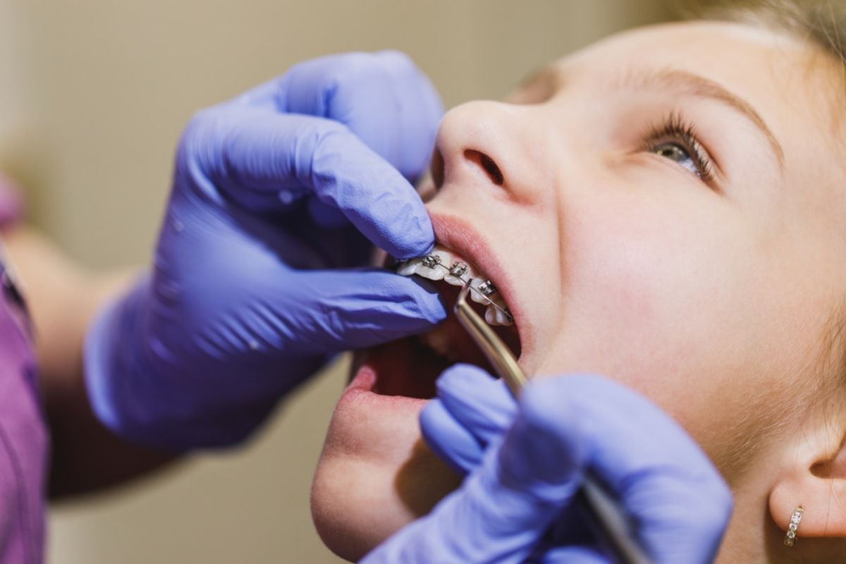 Orthodontist adjusting metal braces on young patient's teeth during dental treatment.