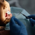 Pediatric dentist in blue gloves examining child's teeth with dental mirror and tools.