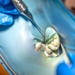 Dentist examining tooth cavity with dental mirror and explorer tool during examination.