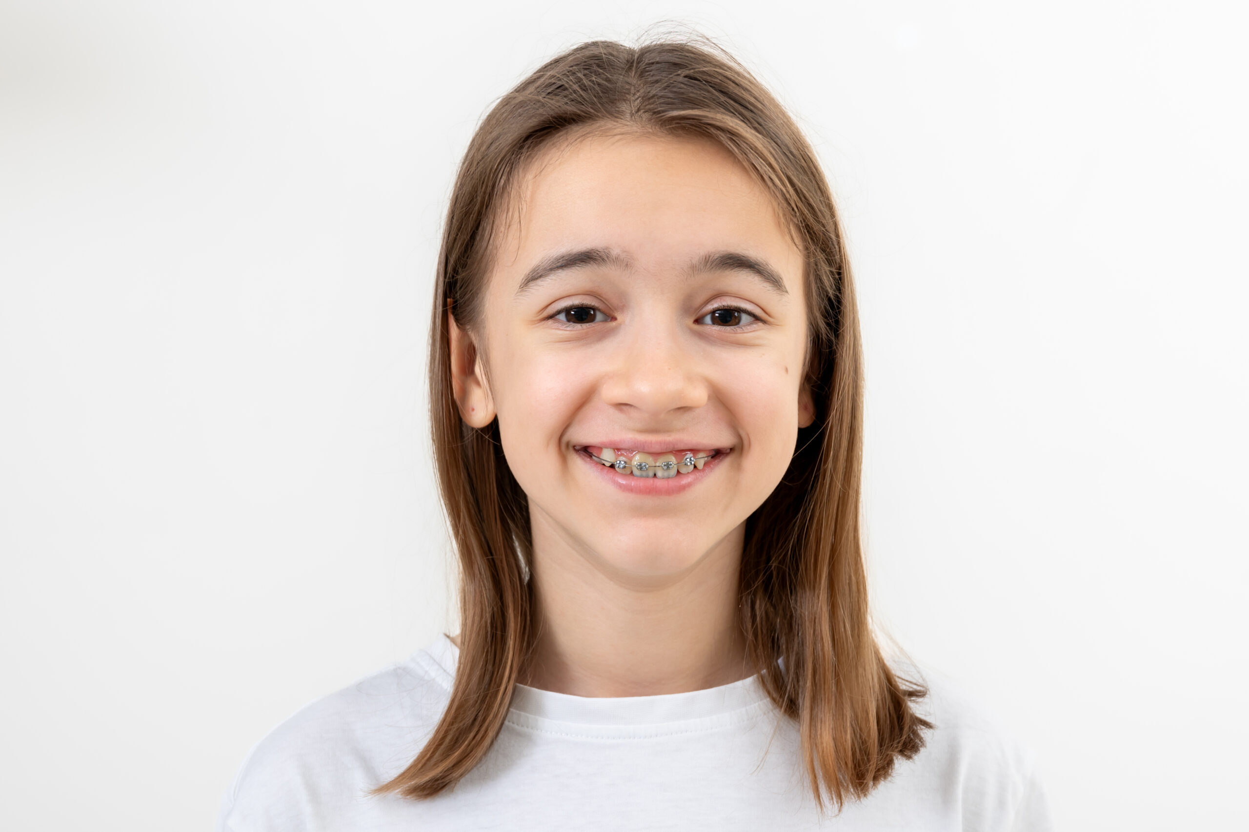 Young girl with braces smiling at dental office in Spring, TX.