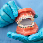 Orthodontist holding dental model with colorful braces showing proper bracket placement and wire alignment.