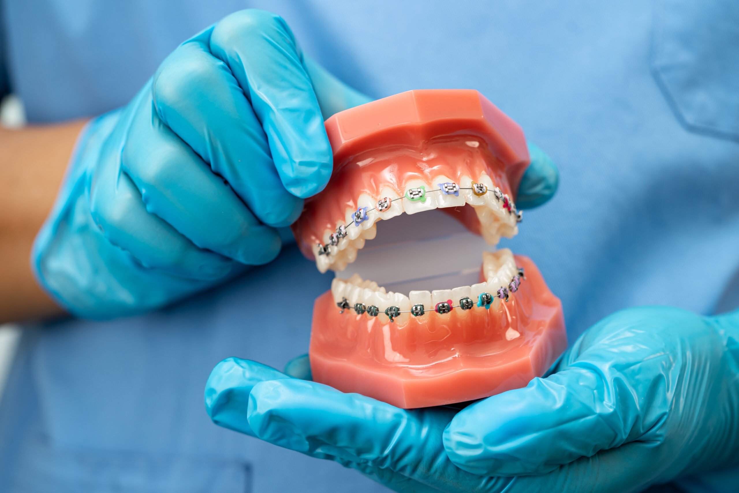 Orthodontist holding dental model with colorful braces showing proper bracket placement and wire alignment.