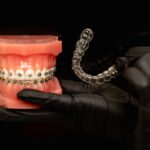 Orthodontic model showing metal braces and clear aligner treatment options for Spring patients.