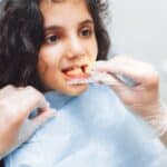 Child receiving clear aligner tray placement during dental visit in Spring, TX.